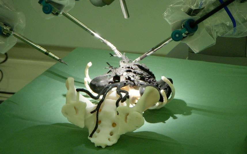 生物3D打印：成为未来医学领域的破局者