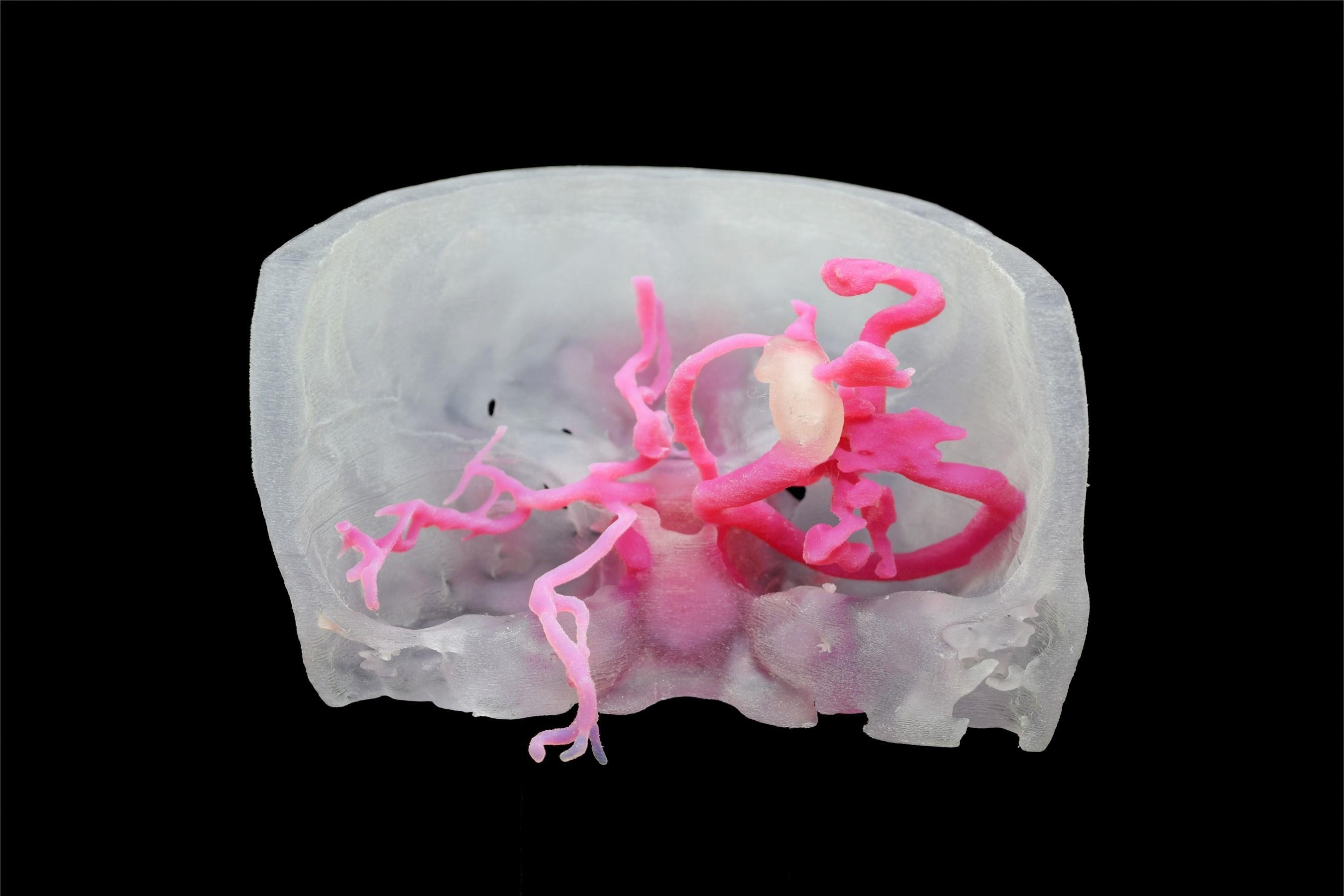 生物3D打印：革命性的医疗技术